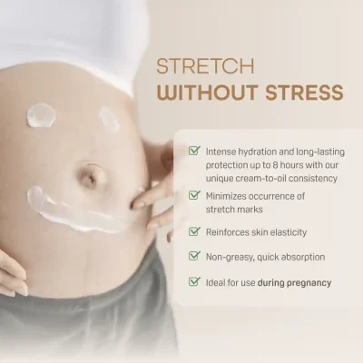 Pigeon Maternity Stretch Marks Cream